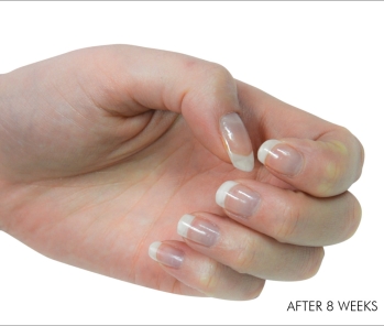 Nailtiques Beautiful Natural Nails Within Weeks