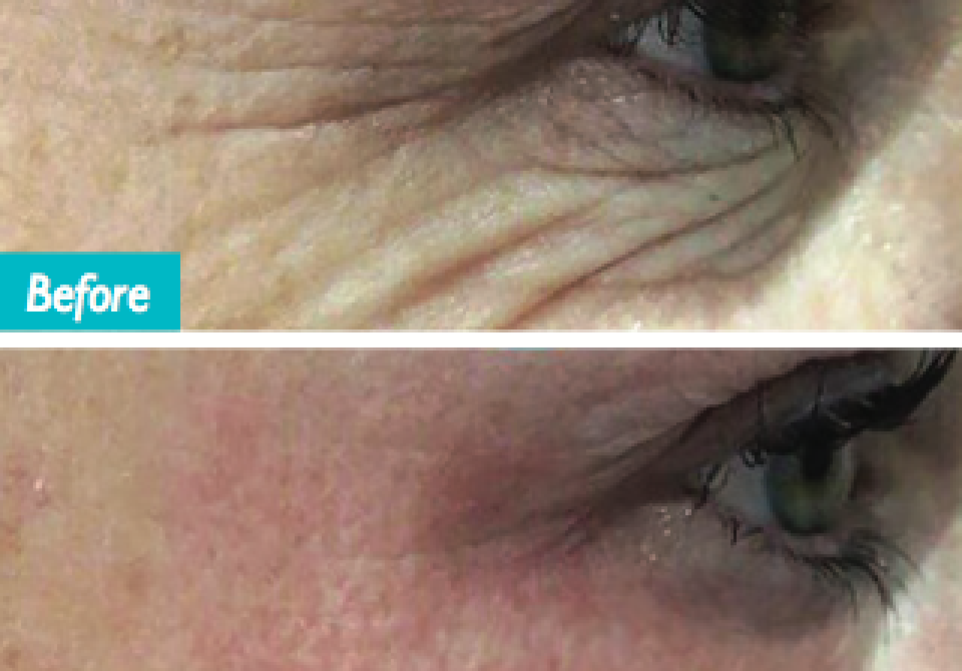Do you dream of tighter, fresher, more youthful skin?