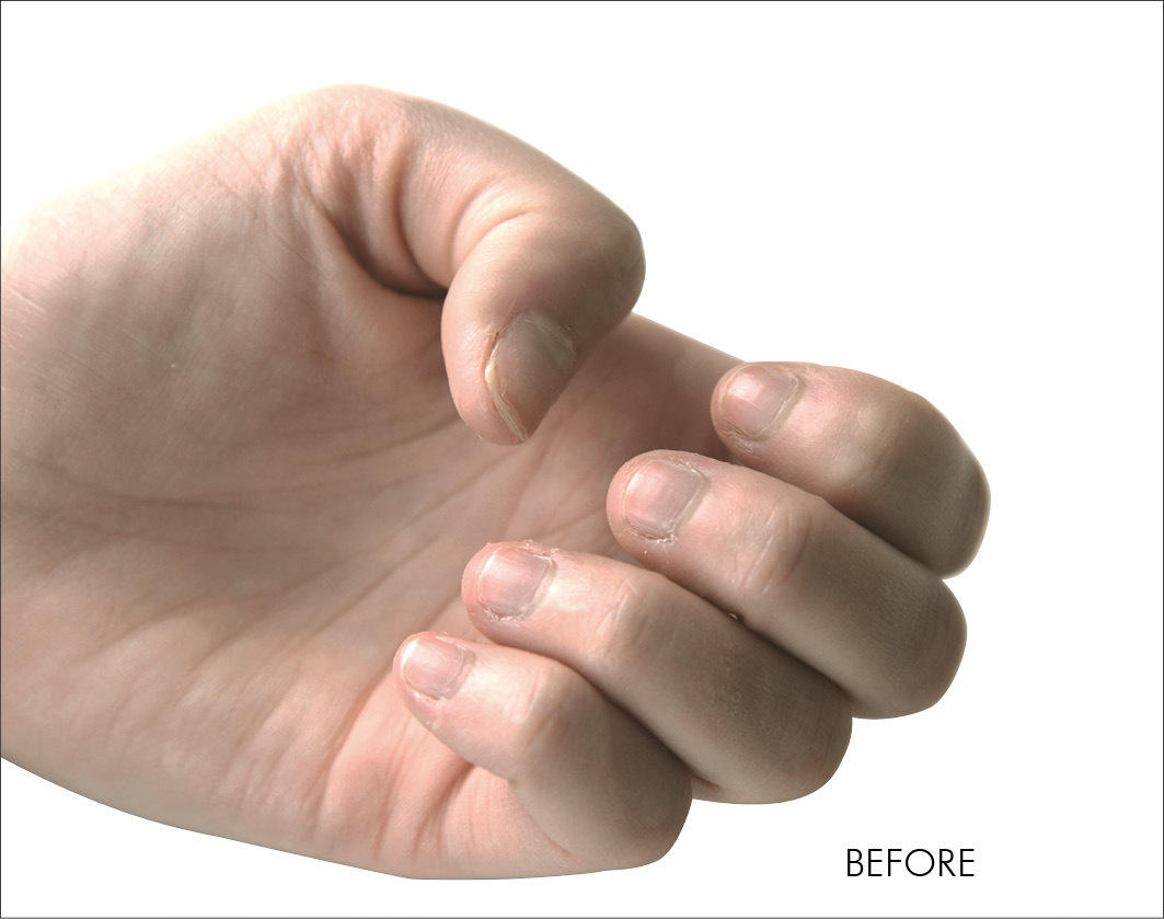 Nailtiques F2 Beforeandafter