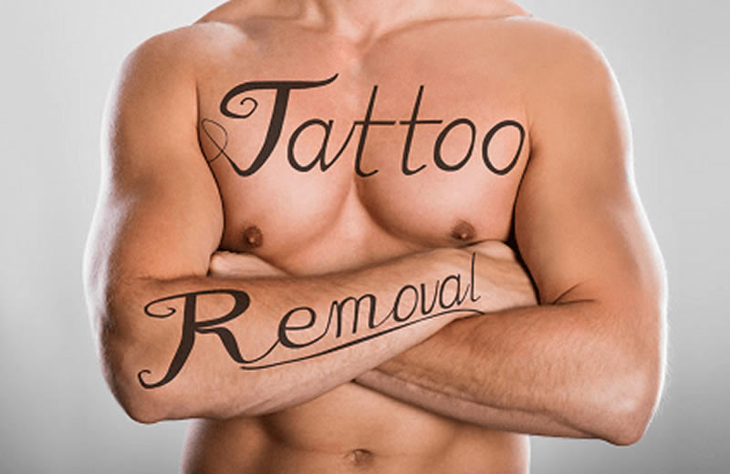  Laser Tattoo Removal Training Course