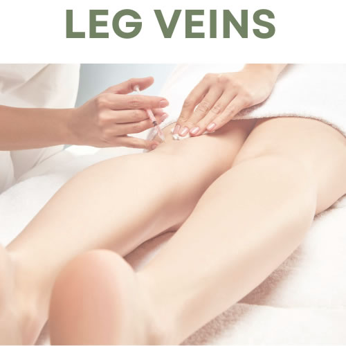 Leg Veins