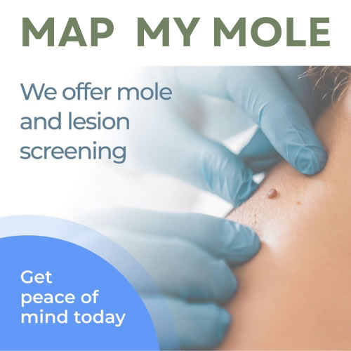 Map My Mole